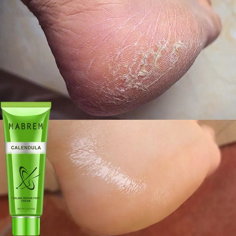 Magic Pro Calendula Soft Nourishing Foot Cream